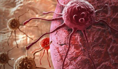 Kansere Genel Bakış ve Tedavi