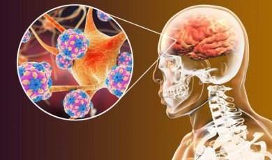 Nörodejeneratif Hastalıklar