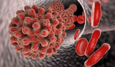 Hepatit, karaciğeri etkileyen viral bir enfeksiyondur